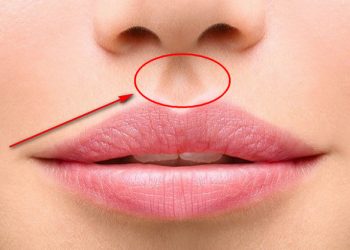 Huyệt nhân trung là gì?