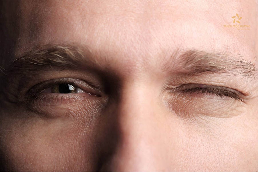 Giải mã bí ẩn về hiện tượng nháy mắt